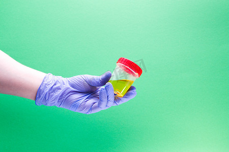 戴着蓝色一次性手套的女手拿着一个测试罐，里面有黄色液体、绿色背景、复制空间