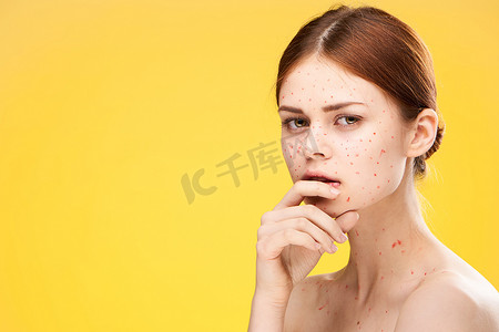 裸肩女人脸上有红点健康问题皮肤科