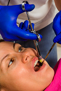 麻醉摄影照片_局部麻醉，牙医腕注射器注射患者的牙龈麻醉，牙科腕注射器。