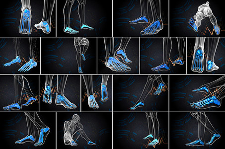 脚骨的 3D 渲染医学插图