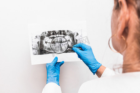 张牙舞爪狮子摄影照片_一位戴着防护医用手套的女医生手里拿着一张牙齿的 X 光照片，并通过白色背景的放大镜进行检查，特写