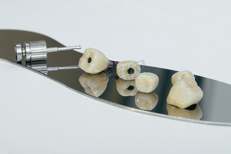 整体螺钉将锆牙冠保留在种植体上，还有一个螺钉和一个用于拧紧牙冠的手动钥匙。