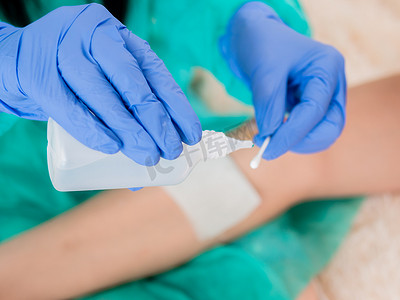 擦伤口摄影照片_医生戴着蓝色无菌手套，将消毒剂倒在棉签上，治疗病人的擦伤。