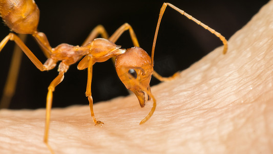 蚂蚁（红蚂蚁）咬人皮肤的宏观