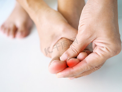 赤脚摄影照片_脚趾疼痛发炎的亚洲年轻女性特写