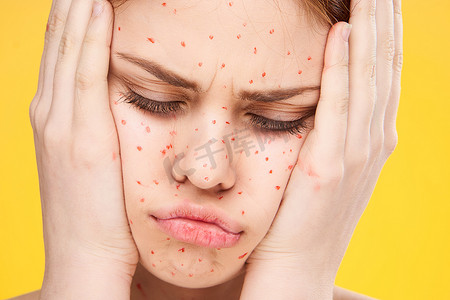 脸上有红点的女人皮肤问题皮肤科不满意