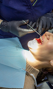 一位女士去看牙医，用牙套替换牙弓。