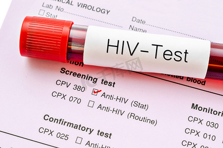 HIV 测试，HIV 感染筛查测试表。