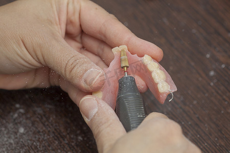 牙科技师用电动工具在凹痕中制作假牙