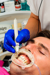牙科实践中，牙医在超声波的帮助下去除牙齿上的结石和硬斑，患者嘴里有牵开器和唾液喷射器。