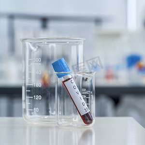 白色实验室桌上 19 名 covid 患者的采血管。