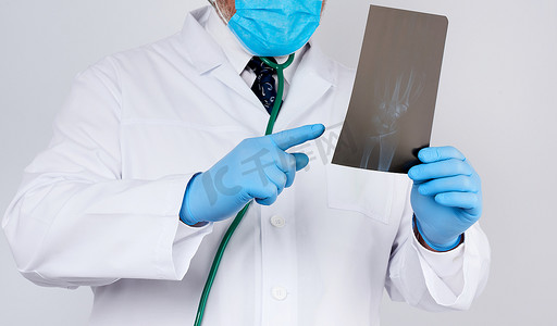 一件白色外套和蓝色乳汁手套的医生拿着a的X-射线