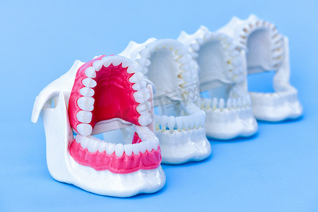 牙医正畸牙齿模型
