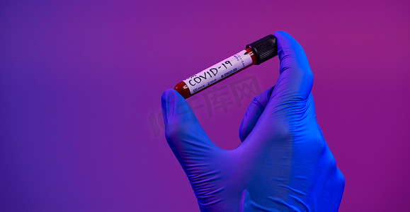 冠状病毒，持有阳性covid-19病毒血液样本试管的医生