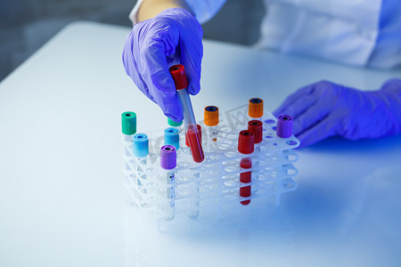 医疗专业人员、实验室助理、医生在实验室进行分析，使用试管、移液器和培养皿来检测人体内细菌的存在。