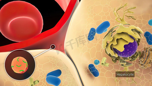丙型肝炎是由丙型肝炎病毒引起的肝脏炎症