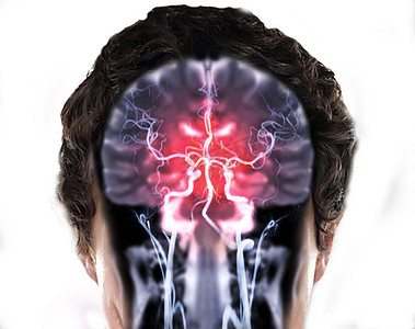 冠状面视图中的 MRI 脑部冠状 T2W 和 MRA 脑部融合。