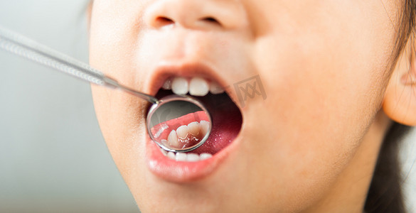 口腔医生摄影照片_医生检查小孩口腔使用口镜检查牙洞