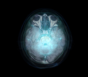 头骨与大脑的透明图像，用于医学背景概念。