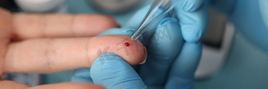 医生用玻璃管抽取顾客手指的血液，这是诊所的常规程序