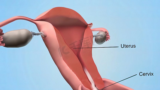 子宫堵塞摄影照片_女性的内生殖器官是阴道、子宫、输卵管和卵巢。