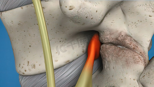 腰椎手术摄影照片_蓝色背景上脊髓的 3D 插图。