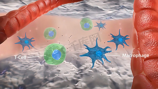 T摄影照片_血管炎中 T 细胞巨噬细胞相互作用和肉芽肿形成