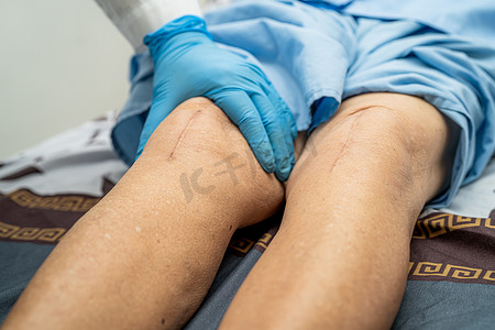 半透明红条摄影照片_亚洲医生将富含透明质酸血小板的血浆注射到老年妇女的膝盖中，使其行走无痛。