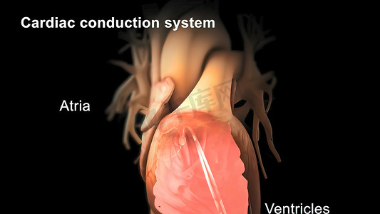 导管消融是用无线电波治疗心律失常。