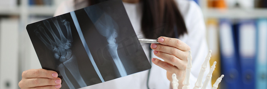 创伤学摄影照片_创伤科医生用手臂损伤特写检查 X 光片