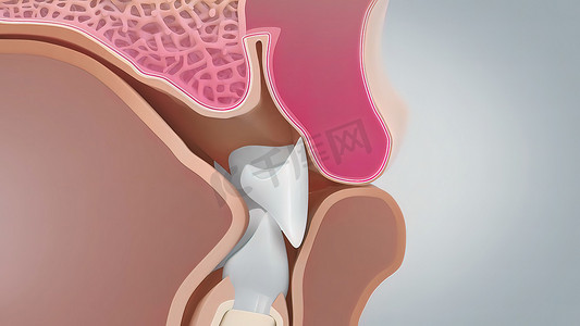 如果牙龈退缩过多，可能会导致骨质流失，从而导致牙齿松动或脱落。