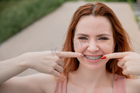 夏天，牙齿上戴着牙套的红发年轻女子在户外微笑