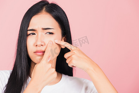 脸上有痘痘摄影照片_有皮肤问题的女士脸上挤痘痘