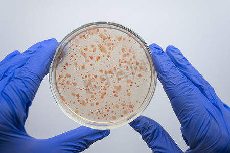 确认调补摄影照片_一位科学家的两只戴着手套的手拿着装有红色细菌的培养皿。