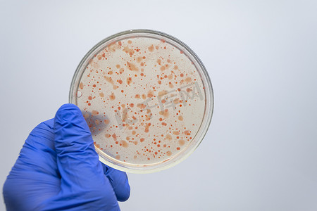 科学家正在研究肠道微生物群。