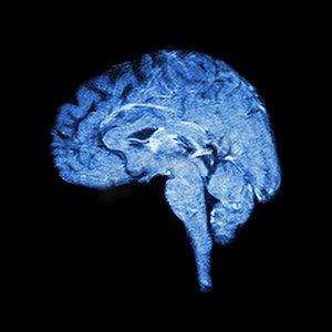 大脑磁共振成像 (MRI)（医学、科学和保健概念）