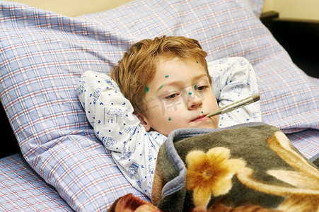 躺在床上摄影照片_生病的孩子男孩躺在床上与水痘