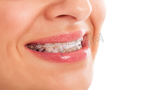 牙齿白化摄影照片_牙齿白化  
