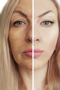 之前和之后摄影照片_妇女的皱纹面对之前和之后的程序