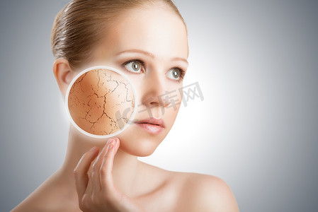 化妆品皮肤护理的概念。与干燥滑雪的年轻女人的脸