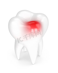 痛摄影照片_用白色的牙痛牙齿的 3d 渲染