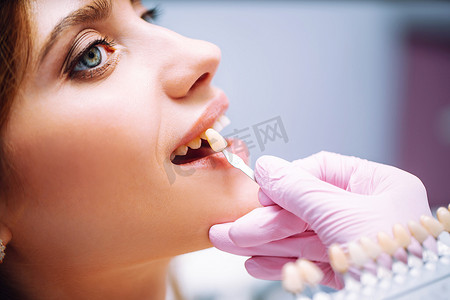 植入物摄影照片_美丽的女人面带微笑,牙齿洁白健康.匹配植入物的阴影或牙齿美白的过程。健康的微笑. 