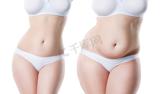 妇女的身体在减肥前后被隔绝在白色背景, 整形外科概念