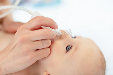 小宝宝的妈妈用吸气器和医疗工具在家里为可爱的男婴擦拭流鼻涕。婴儿父母保健和爱的概念
