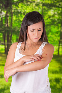 被叮咬摄影照片_关闭的年轻女人患瘙痒后被蚊子叮咬，在模糊的背景