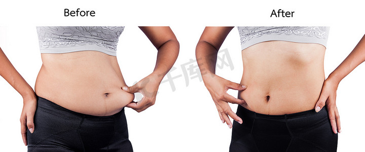女性身体肥胖的肚子之间之前和之后的重量损失