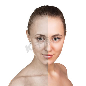 之前和之后摄影照片_年轻女人皮肤护理概念.