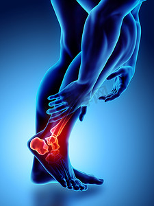 踝关节痛苦-骨骼 x 射线、 3d 插图医学概念.