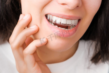 可摄影照片_一个快乐的年轻女人穿着透明的牙套看着镜子，以矫正和美白牙齿。用于矫正咬伤的可移动支架