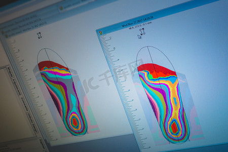 足部扫描分析的矫形器和假肢车间